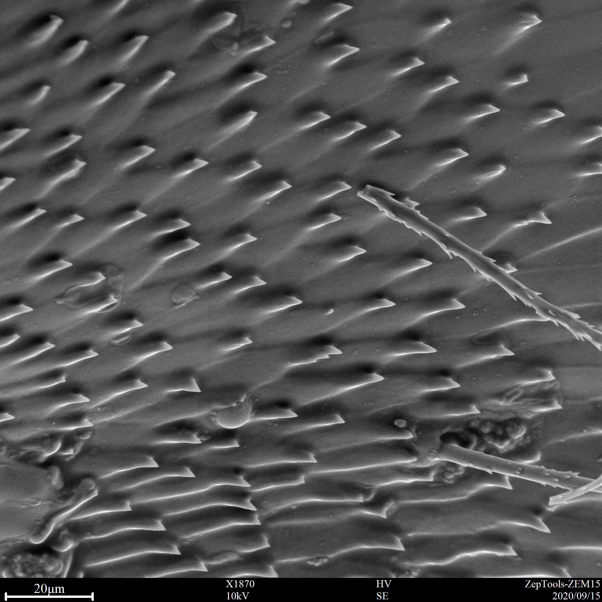 臺式掃描電鏡下生物樣品(會議現場拍攝) 臺式掃描電鏡下生物樣品(會議現場拍攝)
